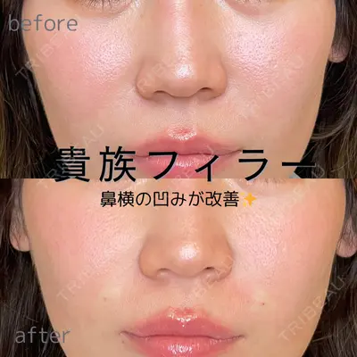 ルラ美容クリニック 仙台院 / ルラスキンクリニック 仙台院 橋本 英樹医師の症例