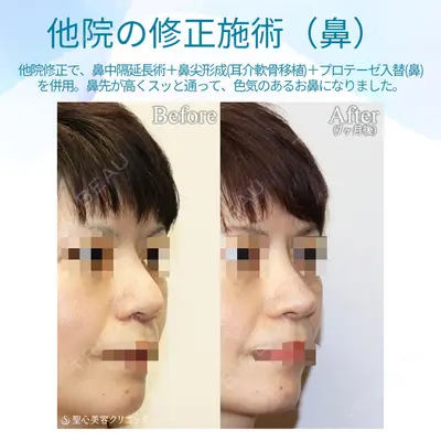 聖心美容クリニック 銀座院 牧野 陽二郎医師の症例