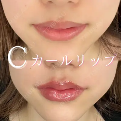 ルラ美容クリニック 広島院の症例