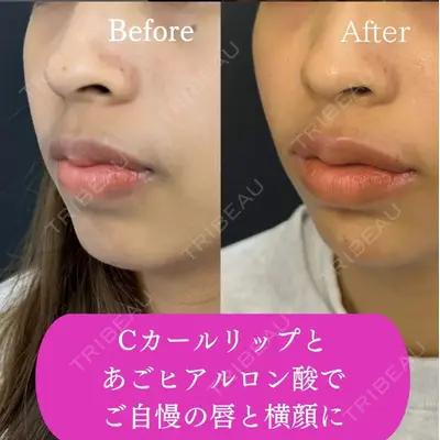 ルラ美容クリニック 渋谷本院の症例