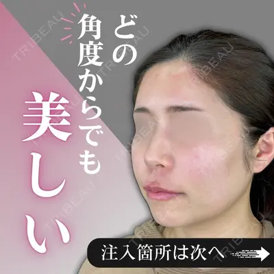 ルラ美容クリニック銀座院 山本 泰輔医師の症例