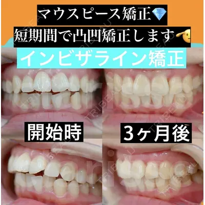 オーラルビューティークリニック クラリス審美歯科・矯正歯科 引野 貴之医師の症例