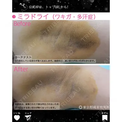 東京形成美容外科 船橋院の症例