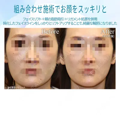 聖心美容クリニック 銀座院 牧野 陽二郎医師の症例
