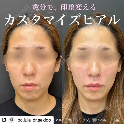 ルラ美容クリニック 名古屋栄院 / ルラスキンクリニック 名古屋栄院 関戸 優医師の症例
