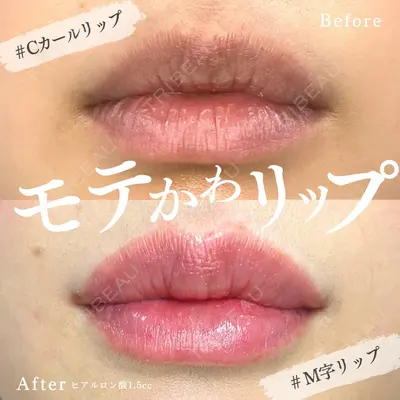 静岡中央クリニック 柳原季栄医師の症例