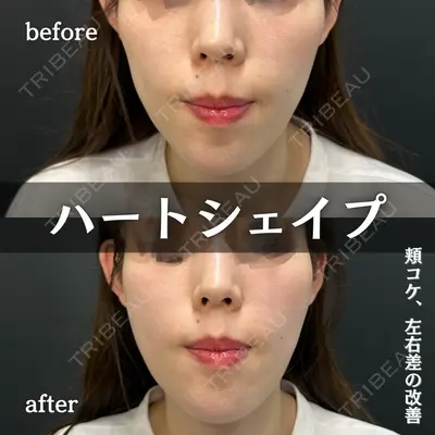 ルラ美容クリニック 新宿院 陶 美梨医師の症例