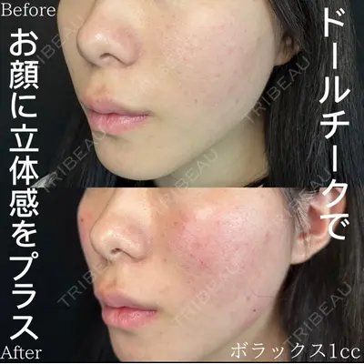 ルラ美容クリニック 渋谷本院の症例