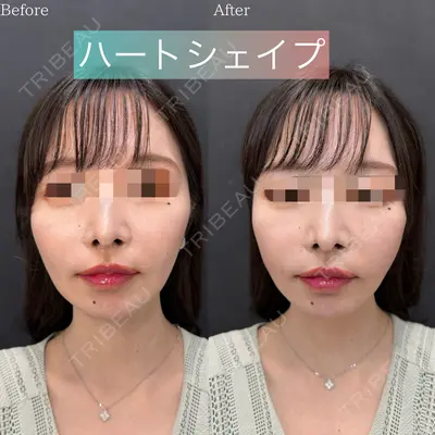 ルラ美容クリニック 渋谷本院の症例