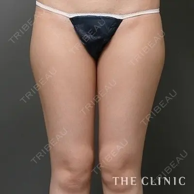 THE CLINIC（ザ・クリニック） 広島院の症例
