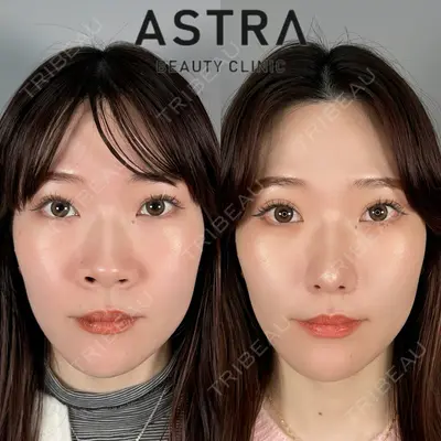 ASTRA BEAUTY CLINIC 塩満 惠子医師の症例