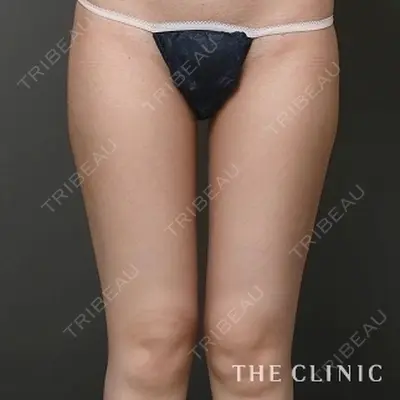 THE CLINIC（ザ・クリニック） 広島院の症例