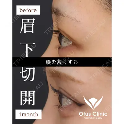 Otus Clinic 【オータスクリニック】 中 徳太郎医師の症例