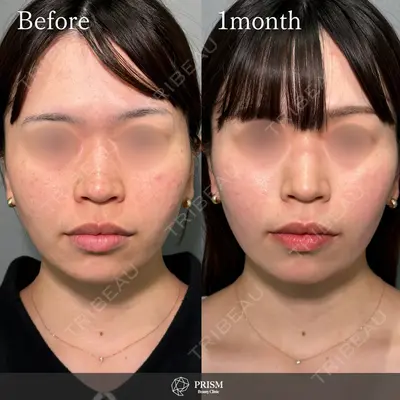 PRISM Beauty Clinic 新宿院 畑山 知輝医師の症例