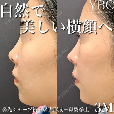 YBC横浜美容外科 池袋院 磯村 亮輔医師の症例