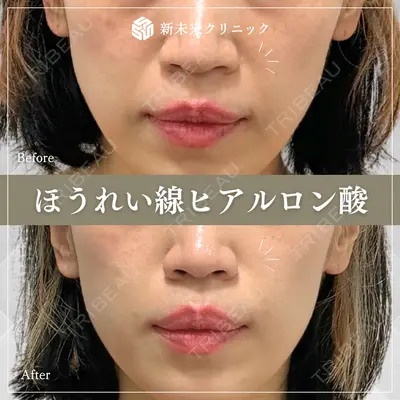 新未来クリニックの症例