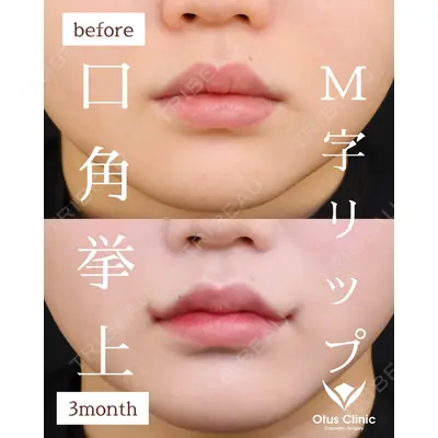 Otus Clinic 【オータスクリニック】 中 徳太郎医師の症例