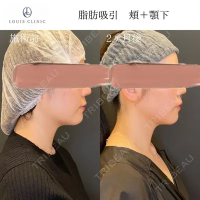 LOUIS CLINIC 二子玉川院【ルイクリニック】 小松 塁医師の症例