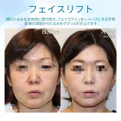 聖心美容クリニック 銀座院 牧野 陽二郎医師の症例
