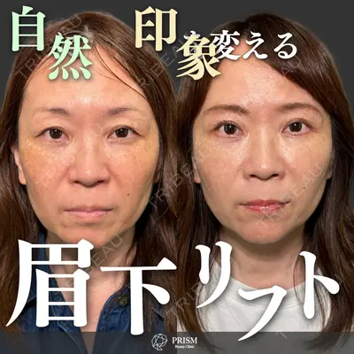 PRISM Beauty Clinic 新宿院 畑山 知輝医師の症例