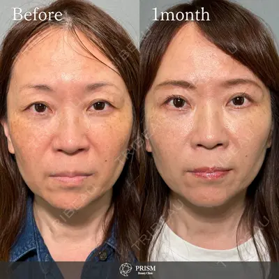 PRISM Beauty Clinic 新宿院 畑山 知輝医師の症例