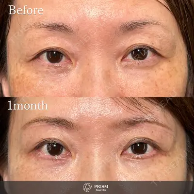 PRISM Beauty Clinic 新宿院 畑山 知輝医師の症例
