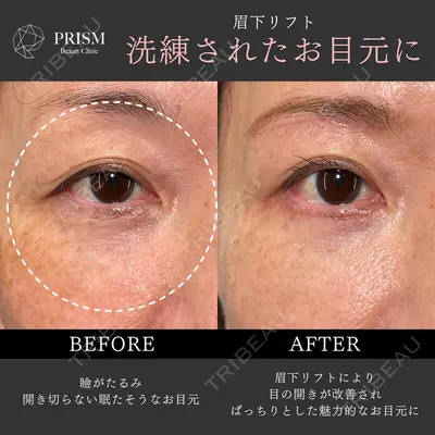 PRISM Beauty Clinic 新宿院 畑山 知輝医師の症例