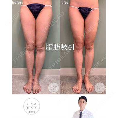 くさのたろうクリニックの症例