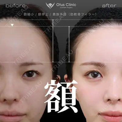 Otus Clinic 【オータスクリニック】 中 徳太郎医師の症例