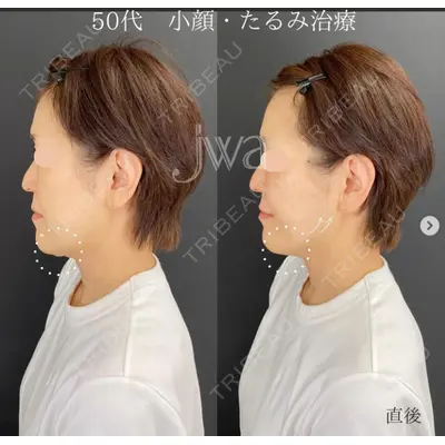 自由が丘ウェルエイジングビューティークリニック 福田 知佐子医師の症例