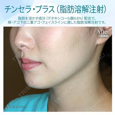 聖心美容クリニック 札幌院 前多 一彦医師の症例