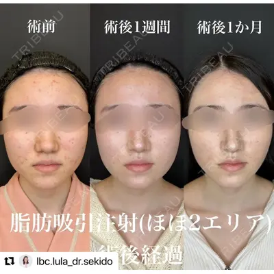 ルラ美容クリニック 名古屋栄院 / ルラスキンクリニック 名古屋栄院 関戸 優医師の症例