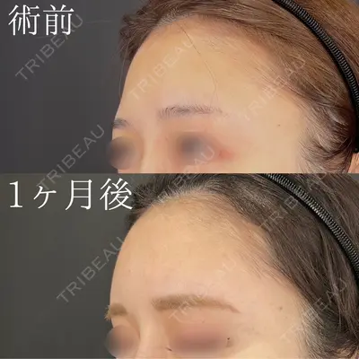 HAAB×DREAM BEAUTY CLINIC 大阪梅田院 鈴木 馨斗医師の症例