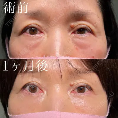 HAAB×DREAM BEAUTY CLINIC 大阪梅田院 鈴木 馨斗医師の症例
