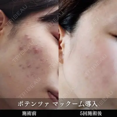 ルラ美容クリニック 池袋院 小海 元｜長期休暇につき指名不可医師の症例