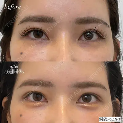 DMTC CLINIC 日本橋院 松井泉医師の症例