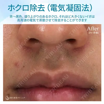 聖心美容クリニック 熱海院 小林 美幸（皮膚科）医師の症例