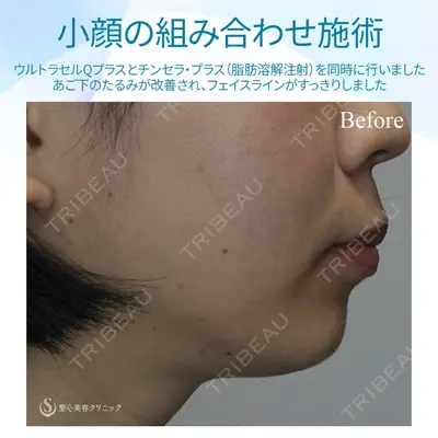 聖心美容クリニック 六本木院 菱田 健作医師の症例