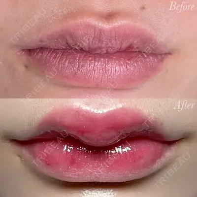 R Beauty CLINIC 大阪院 小池 泰弘医師の症例