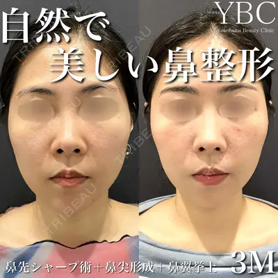 YBC横浜美容外科 池袋院 磯村 亮輔医師の症例