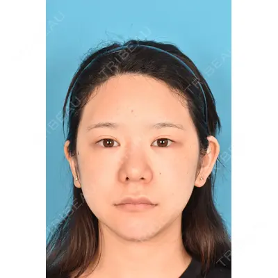 アネシス美容クリニック 水野　力医師の症例