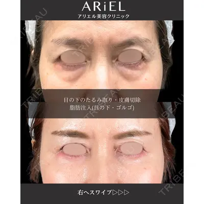 アリエル美容クリニック 大宮院 鈴木　桂介医師の症例