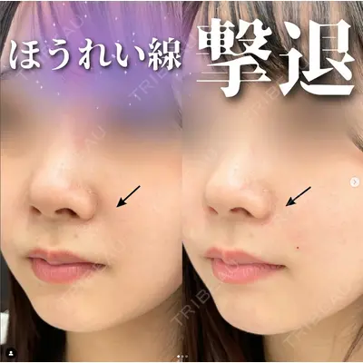 ルラ美容クリニック 町田院の症例