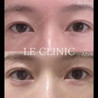 LE CLINIC 喜多　俊博医師の症例