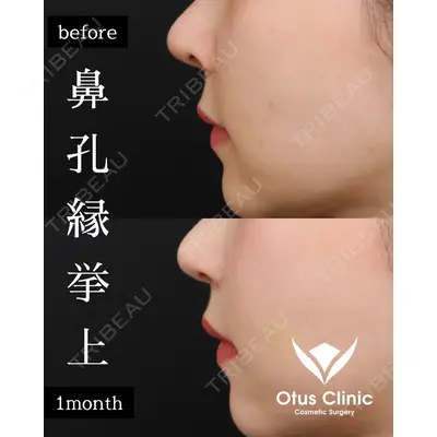 Otus Clinic 【オータスクリニック】 中 徳太郎医師の症例