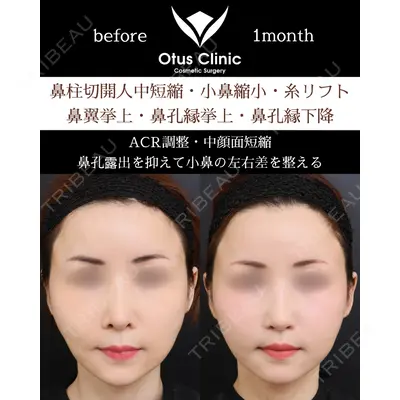 Otus Clinic 【オータスクリニック】 中 徳太郎医師の症例