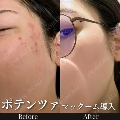 ルラ美容クリニック 池袋院 小海 元｜長期休暇につき指名不可医師の症例