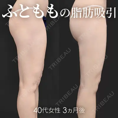 ジョウクリニック 高知院 溝渕　貴俊医師の症例