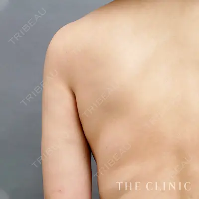 THE CLINIC（ザ・クリニック） 東京院の症例