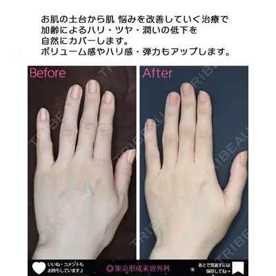 東京形成美容外科 船橋院の症例